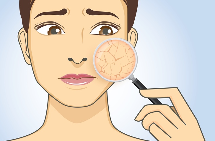 How To Get Rid Of Dry Skin: 17 Home Remedies That Work