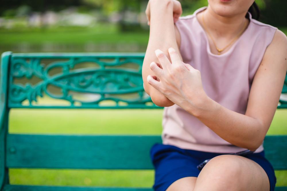 Woman scratching insect bite